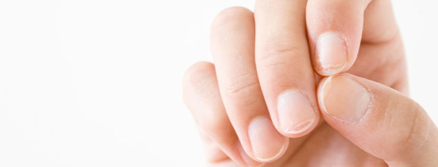 Ongles abîmés : comment les réparer