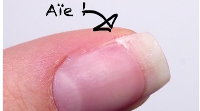Ongle cassé : comment le réparer ?