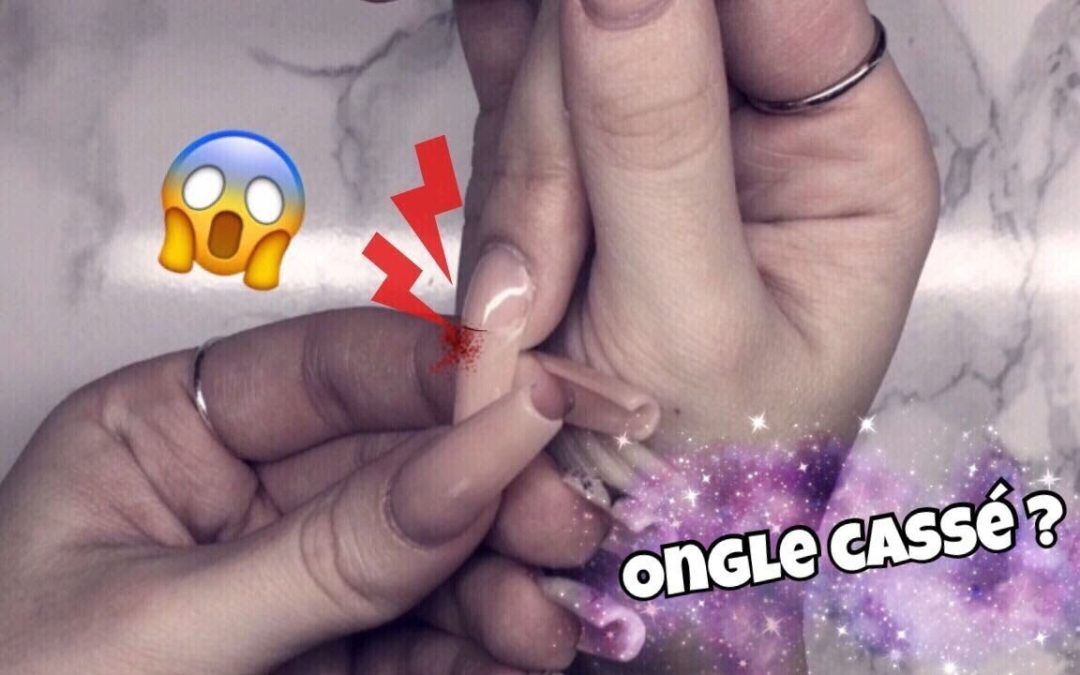 Réparer un ongle en gel cassé ou fissuré