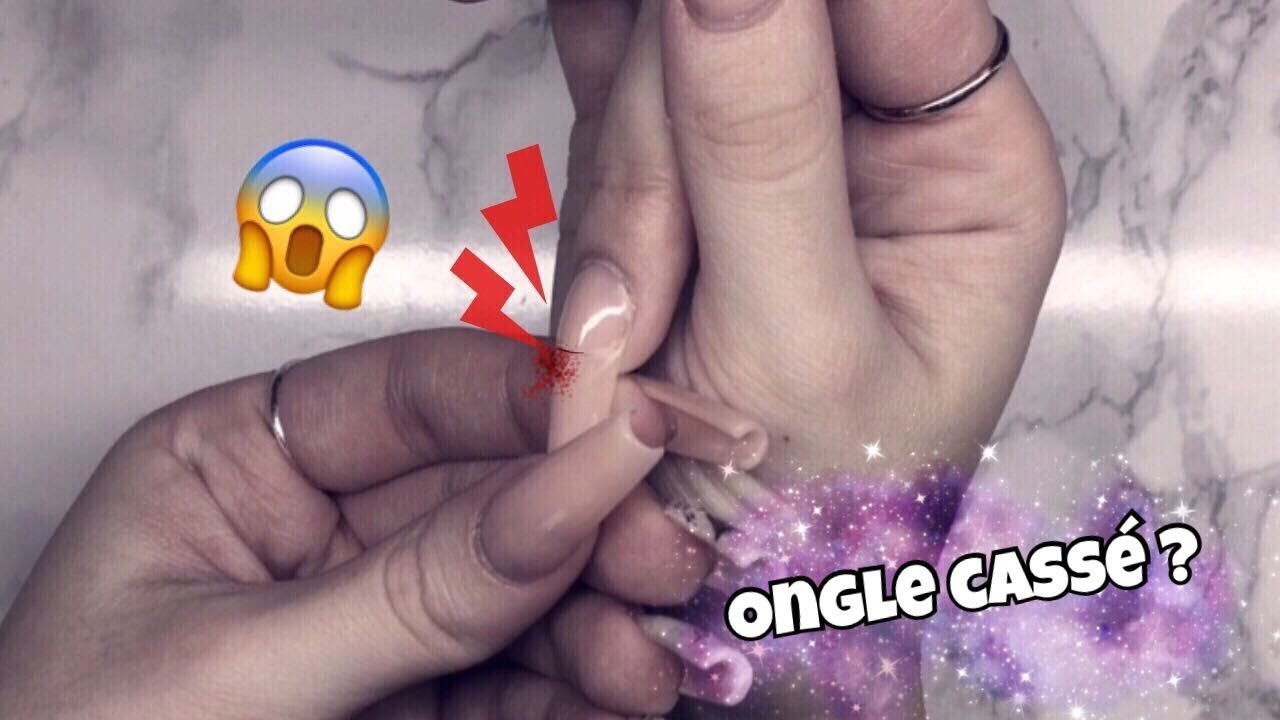 Ongle En Gel Cassé Au Milieu